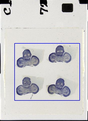 Media type: image; Special Collections 3298   shows specimen_part histological serial section;